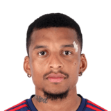 Dalbert